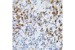 Immunohistochemistry of paraffin-embedded human tonsil using CHAF1B antibody (ABIN5973690) at dilution of 1/100 (40x lens). (CHAF1B 抗体)