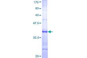 Image no. 1 for Neurocan (NCAN) (AA 81-179) protein (GST tag) (ABIN1312063) (Neurocan Protein (NCAN) (AA 81-179) (GST tag))