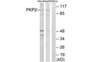 Western Blotting (WB) image for anti-Plakophilin 2 (PKP2) (AA 632-681) antibody (ABIN2890508) (Plakophilin 2 抗体  (AA 632-681))