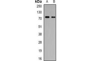 Western blot analysis of GalNAc-T3 expression in MCF7 (A), SW480 (B) whole cell lysates. (GALNT3 抗体)