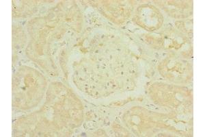 Immunohistochemistry of paraffin-embedded human kidney tissue using ABIN7159887 at dilution of 1:100 (TIMM1B (AA 1-103) 抗体)
