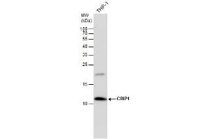 CRIP1 antibody detects CRIP1 protein by western blot analysis. (CRIP1 抗体  (C-Term))