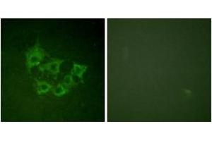 Immunofluorescence analysis of HuvEc cells, using COT (Phospho-Thr290) Antibody. (CROT 抗体  (pThr290))
