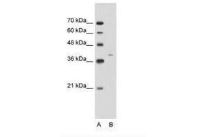 Image no. 1 for anti-Keratin 13 (KRT13) (C-Term) antibody (ABIN203408) (Cytokeratin 13 抗体  (C-Term))