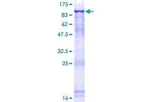 CDC40 Protein (AA 1-579) (GST tag)