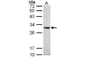 WB Image Sample (30 ug of whole cell lysate) A: Raji 12% SDS PAGE antibody diluted at 1:1000 (DDAH1 抗体  (C-Term))