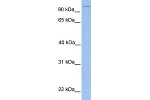 WB Suggested Anti-LPIN1 Antibody Titration: 0. (Lipin 1 抗体  (N-Term))