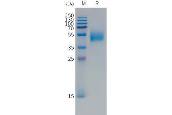 FCRL5 Protein (AA 745-847) (mFc Tag)