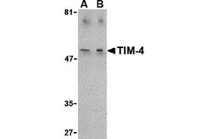 Western Blotting (WB) image for anti-T-Cell Immunoglobulin and Mucin Domain Containing 4 (TIMD4) (C-Term) antibody (ABIN1030736) (TIMD4 抗体  (C-Term))
