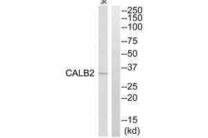 Western Blotting (WB) image for anti-Calbindin 2 (CALB2) (Internal Region) antibody (ABIN1850972) (Calretinin 抗体  (Internal Region))