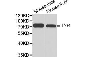 Western blot analysis of extracts of various cell lines, using TYR antibody. (TYR 抗体)