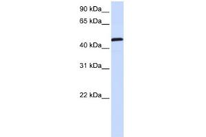 WB Suggested Anti-UMPS Antibody Titration:  0. (UMPS 抗体  (C-Term))