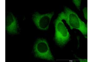 Immunofluorescence of purified MaxPab antibody to GBP1 on HeLa cell. (GBP1 抗体  (AA 1-592))
