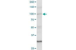 AMOTL1 MaxPab rabbit polyclonal antibody. (AMOTL1 抗体  (AA 1-956))