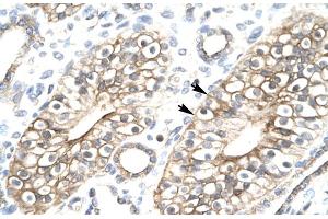 Human kidney (FLJ11730 (N-Term) 抗体)