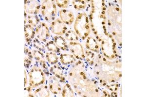 Immunohistochemistry of paraffin-embedded human kidney using IKZF1 antibody at dilution of 1:100 (x400 lens). (IKZF1 抗体)