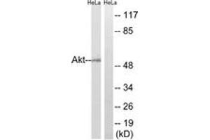 Western blot analysis of extracts from HeLa cells, using Akt (Ab-473) Antibody. (AKT1 抗体  (AA 431-480))