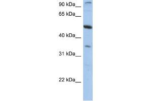 WB Suggested Anti-PLXDC1 Antibody Titration:  0. (PLXDC1 抗体  (N-Term))