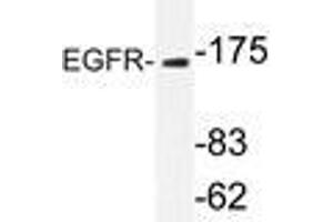 Western blot analysis of EGFR antibody in extracts from Jurkatcells. (EGFR 抗体)