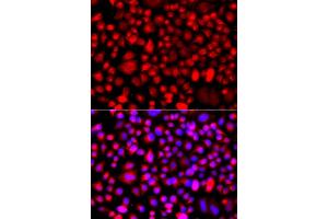 Immunofluorescence analysis of A549 cells using ALG1 antibody (ABIN5975731). (ALG1 抗体)