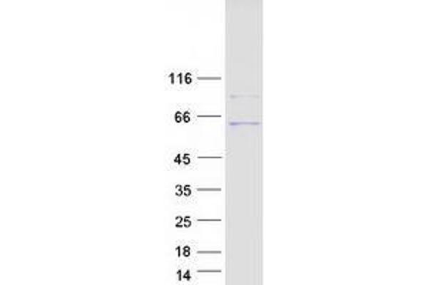 UGT3A1 Protein (Myc-DYKDDDDK Tag)