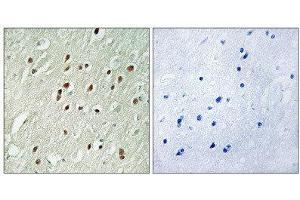 Immunohistochemistry (IHC) image for anti-Centrobin, Centrosomal BRCA2 Interacting Protein (CNTROB) (Internal Region) antibody (ABIN1851053) (CNTROB 抗体  (Internal Region))