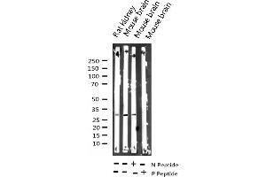 Western blot analysis of Phospho-DARPP-32 (Thr34) expression in various lysates (DARPP32 抗体  (pThr34))