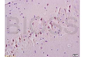 Immunohistochemistry (IHC) image for anti-TGF beta Receptor 1 (AA 301-400) antibody (ABIN671256)