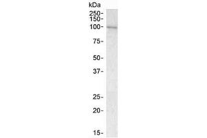 Western blot testing of human bone marrow lysate with VAV3 antibody at 1ug/ml. (VAV3 抗体)