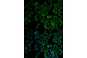 Immunofluorescence analysis of HeLa cells using TNFRSF1A antibody (ABIN1875131). (TNFRSF1A 抗体)