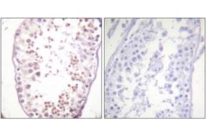 Immunohistochemistry analysis of paraffin-embedded human testis, using HDAC6 (Phospho-Ser22) Antibody. (HDAC6 抗体  (pSer22))