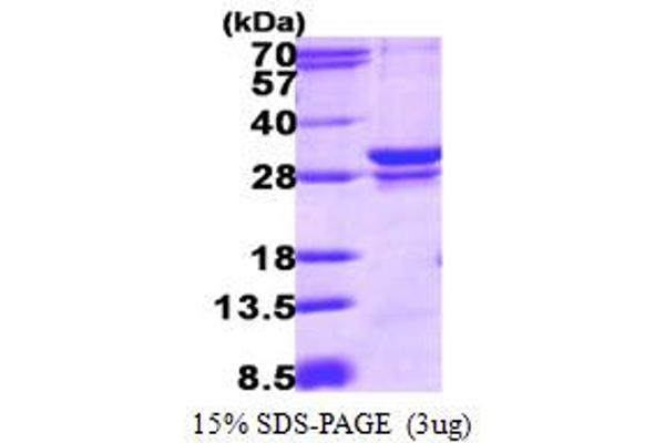 RAB23 Protein (AA 1-234) (His tag)