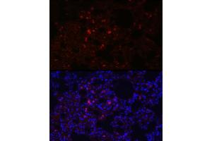 Immunofluorescence analysis of rat lung using SFTPC Rabbit pAb (ABIN3015597, ABIN3015598, ABIN3015599, ABIN1682683 and ABIN6218961) at dilution of 1:100 (40x lens). (Surfactant Protein C 抗体  (AA 1-197))