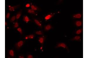 Immunofluorescence analysis of U2OS cells using HNRNPF antibody. (HNRNPF 抗体  (AA 1-280))