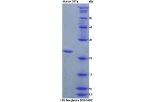 SDS-PAGE (SDS) image for Glutathione S-Transferase pi 1 (GSTP1) ELISA Kit (ABIN6574253)