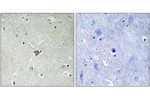 Immunohistochemistry (IHC) image for anti-BCL2-Associated X Protein (BAX) (AA 143-192) antibody (ABIN2889141) (BAX 抗体  (AA 143-192))