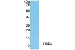 Detection of Recombinant MCP5, Mouse using Polyclonal Antibody to Monocyte Chemotactic Protein 5 (MCP5) (Ccl12 抗体  (AA 28-104))