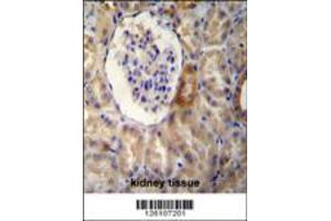 NR3C1 Antibody immunohistochemistry analysis in formalin fixed and paraffin embedded human kidney tissue followed by peroxidase conjugation of the secondary antibody and DAB staining. (Glucocorticoid Receptor 抗体  (C-Term))