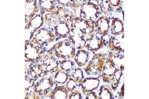Immunohistochemistry of paraffin-embedded mouse kidney using NOX/p67phox Rabbit mAb (ABIN1679067, ABIN7101556, ABIN7101557 and ABIN7101558) at dilution of 1:100 (40x lens). (NCF2 抗体)