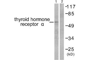 Western blot analysis of extracts from SKOV3 cells, using Thyroid Hormone Receptor alpha antibody (ABIN5976520). (THRA 抗体  (N-Term))
