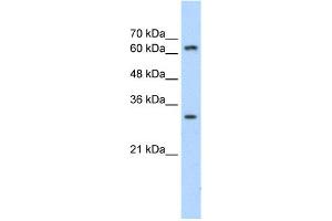 WB Suggested Anti-MTA2 Antibody Titration:  1. (MTA2 抗体  (C-Term))