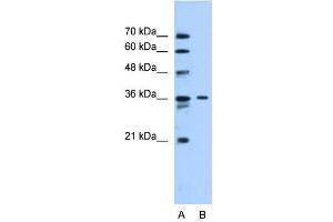 SLC35A3 antibody used at 0. (SLC35A3 抗体)