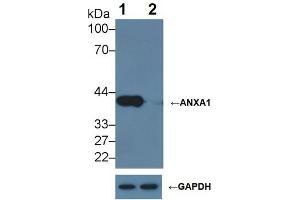Knockout Varification: ;Lane 1: Wild-type Hela cell lysate; ;Lane 2: ANXA1 knockout Hela cell lysate; ;Predicted MW: 39kDa ;Observed MW: 39kDa;Primary Ab: 2µg/ml Mouse Anti-Human ANXA1 Antibody;Second Ab: 0. (Annexin a1 抗体  (AA 1-346))