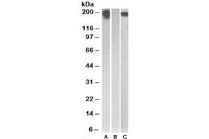 Western blot testing of HEK293 lysate overexpressing Human CSF1R with MYC tag with CSF1R antibody (0. (CSF1R 抗体)