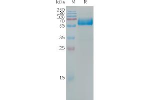 OLR1 Protein (Fc Tag)