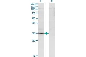 Western Blotting (WB) image for anti-TGFB-Induced Factor Homeobox 2 (TGIF2) (AA 1-238) antibody (ABIN961323) (TGIF2 抗体  (AA 1-238))