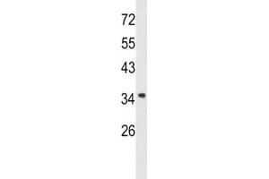 Western blot analysis of Annexin A1 antibody and A2058 lysate. (Annexin a1 抗体  (AA 129-158))