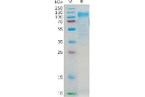 Human CD36 Protein, hFc Tag on SDS-PAGE under reducing condition. (CD36 Protein (CD36) (AA 30-439) (Fc Tag))