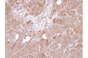 IHC-P Image Immunohistochemical analysis of paraffin-embedded SW480 xenograft, using AHA-1 , antibody at 1:100 dilution. (AHSA1 抗体  (Center))