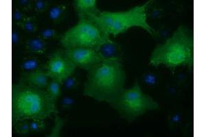 Anti-KHK mouse monoclonal antibody (ABIN2453195) immunofluorescent staining of COS7 cells transiently transfected by pCMV6-ENTRY KHK (RC202424). (Ketohexokinase 抗体)